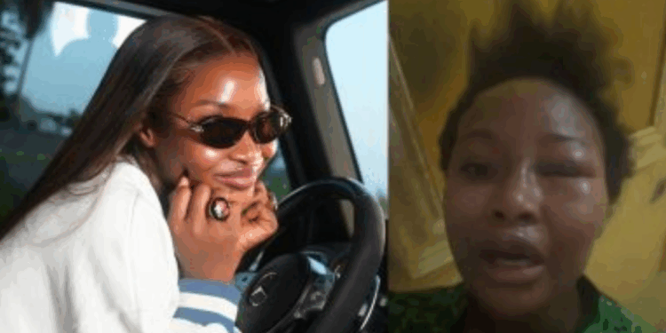 BBNaija Star Ilebaye Hospitalised After Alleged Assault By Father In Abuja
