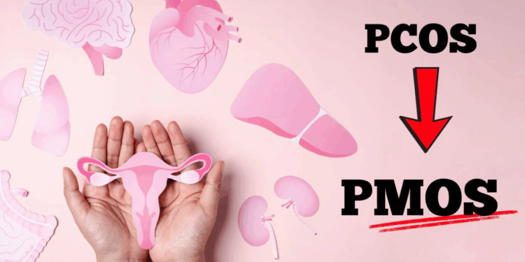 PCOS Is Now Being Called PMOS: What This Means